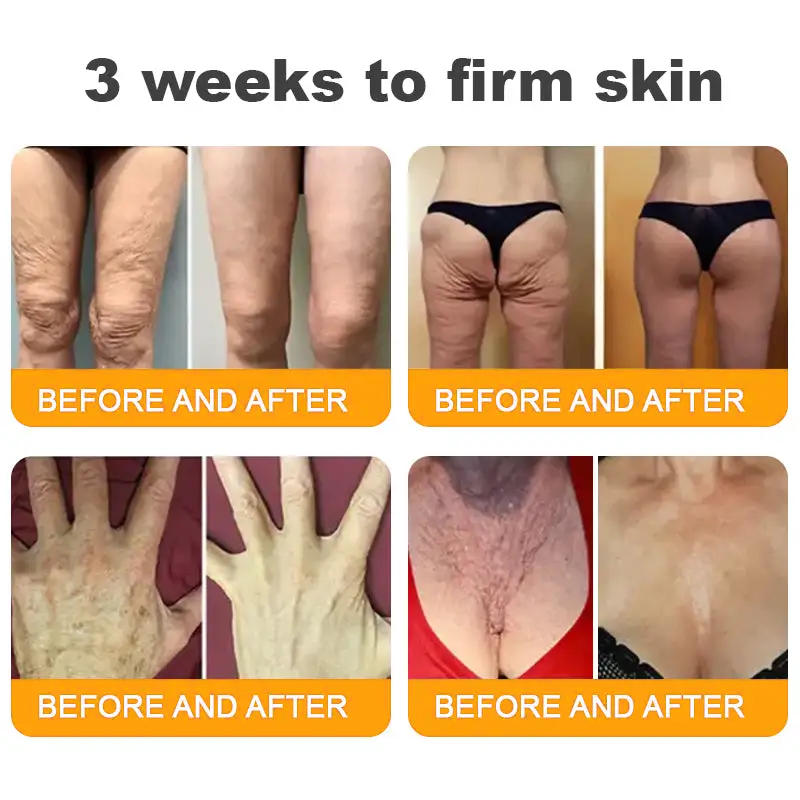 Made and Shipped from USA ✨ ODALIT® Bee Venom Skin Restoration Cream ⏰ LAST DAY 80% OFF💌