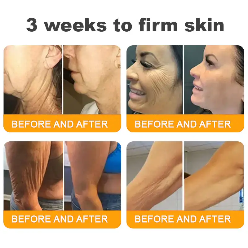 Made and Shipped from USA ✨ ODALIT® Bee Venom Skin Restoration Cream ⏰ LAST DAY 80% OFF💌