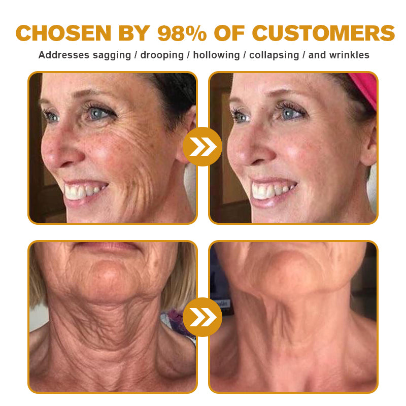 (Made and Shipped from USA) 🧑⚕️NEGUSY® Botox Bee Venom Wrinkle Removal Cream