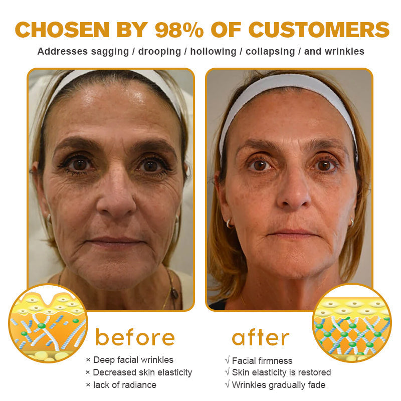 (Made and Shipped from USA) 🧑⚕️NEGUSY® Botox Bee Venom Wrinkle Removal Cream