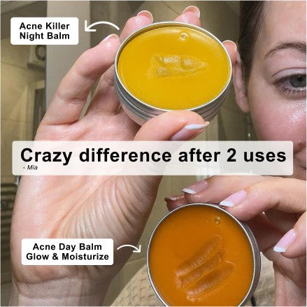 Kill Acne & Redness Ritual-Limited-Time🌲 Christmas Sale: 50% Off🎁