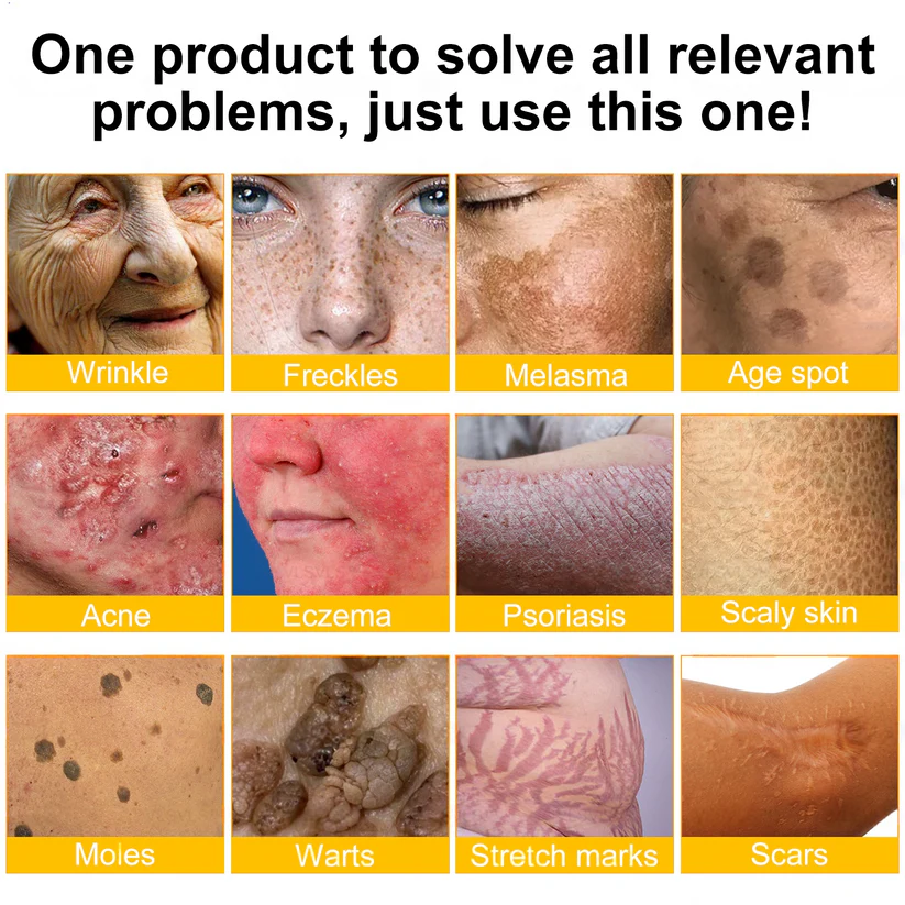 ✨FDA Approved: ODALIT® Bee Venom Skin Restoration Cream