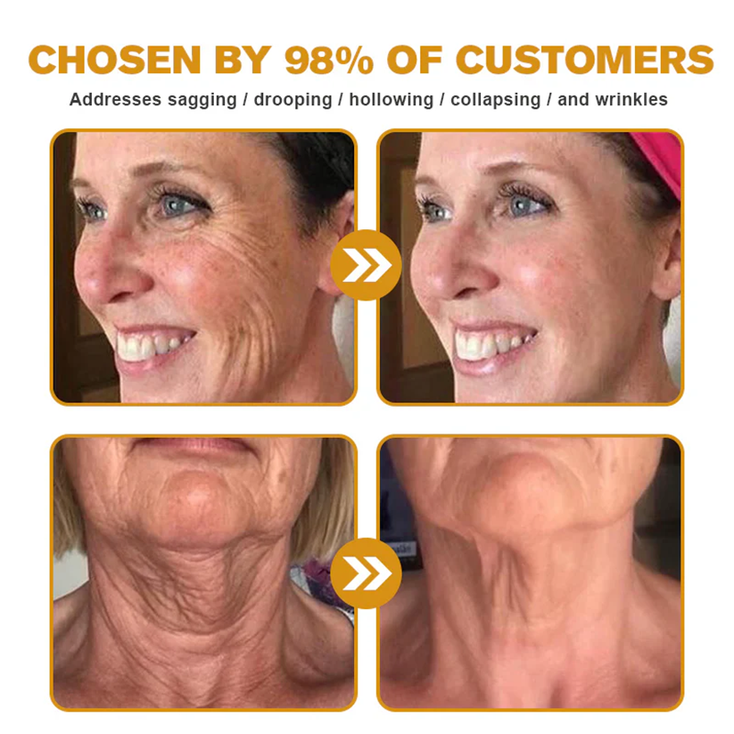 ✨FDA Approved: ODALIT® Bee Venom Skin Restoration Cream — 🔥Limited Time 50% OFF🔥