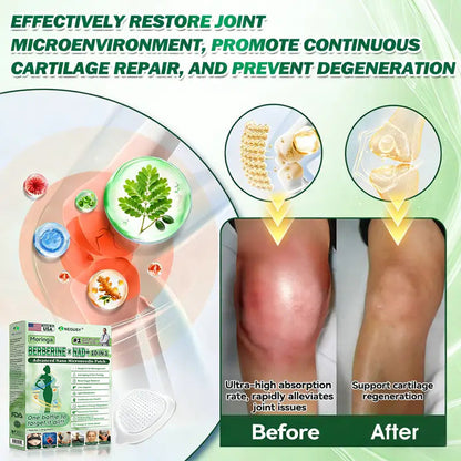 𝐎𝐟𝐟𝐢𝐜𝐢𝐚𝐥 𝐒𝐭𝐨𝐫𝐞 🇺🇸 |NEGUSY™ Moringa .Berberine x NAD+ 10-in-1 Advanced Nano Microneedle Patch - Once Daily, Visible Results in 7Days