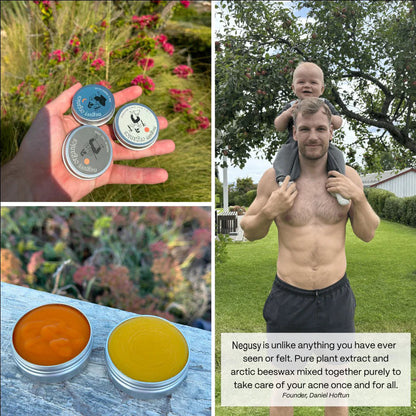 Kill Acne & Redness Ritual-Limited-Time🌲 Christmas Sale: 50% Off🎁