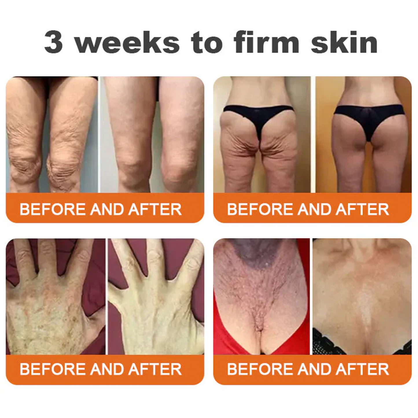 ✨FDA Approved: ODALIT® Bee Venom Skin Restoration Cream — 🔥Limited Time 50% OFF🔥