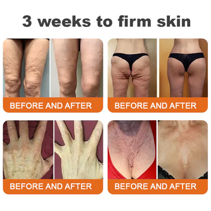 ✨FDA Approved: ODALIT® Bee Venom Skin Restoration Cream — 🔥Limited Time 50% OFF🔥