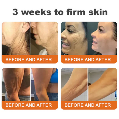 ✨FDA Approved: ODALIT® Bee Venom Skin Restoration Cream