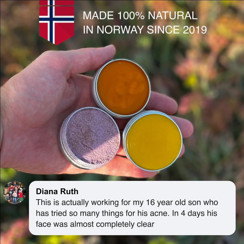 Kill Acne & Redness Ritual-Limited-Time🌲 Christmas Sale: 50% Off🎁