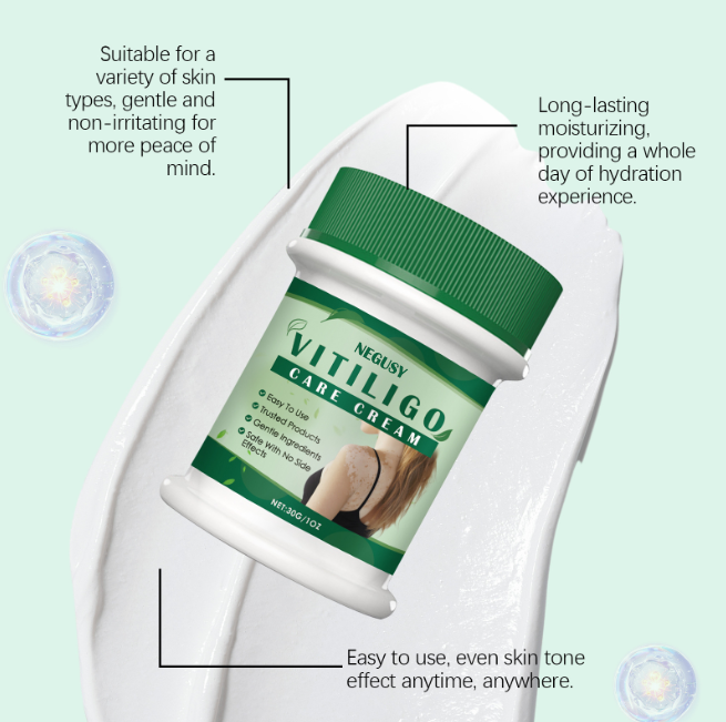 🎁Buy 2 Get 1 free——NEGUSY™ Botanical Vitiligo Repair Cream (Stop Hiding Protocol) 🌿