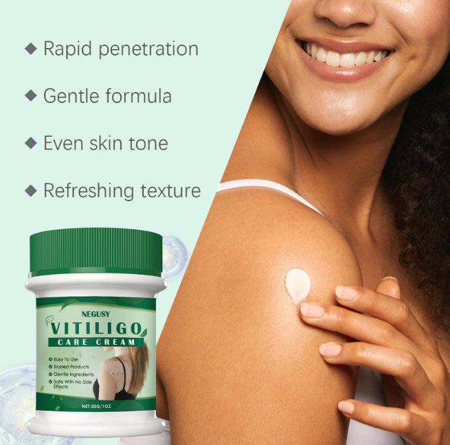 🎁Buy 2 Get 1 free——NEGUSY™ Botanical Vitiligo Repair Cream (Stop Hiding Protocol) 🌿