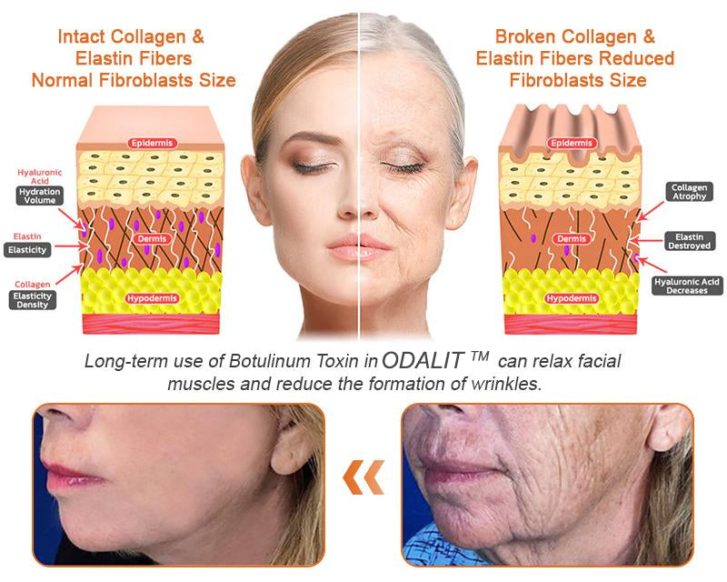 ✨FDA Approved: ODALIT® Bee Venom Skin Restoration Cream