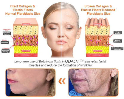 ✨FDA Approved: ODALIT® Bee Venom Skin Restoration Cream