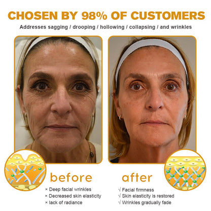 (Made and Shipped from USA) 🧑‍⚕️NEGUSY® Botox Bee Venom Wrinkle Removal Cream